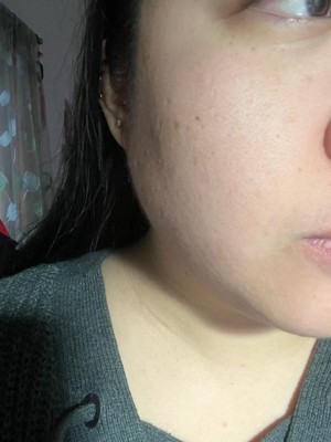 Guest review image 1 of 3, zoom in