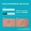 Mediheal Madecassoside Blemish Repair Serum - 1.35 oz - 4 of 4