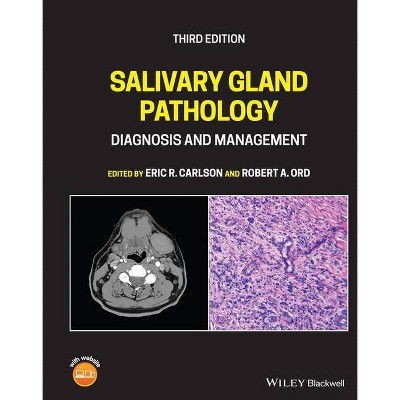 Salivary Gland Pathology - 3rd Edition by  Eric R Carlson & Robert A Ord (Hardcover)