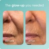 Biosil Collagen Generator - With Patented ch-OSA Complex - Generates & Protects Your Own Collagen - GMO Free - 4 of 4