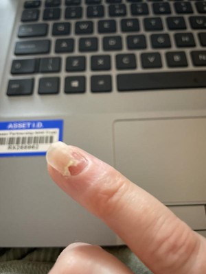 Guest review image 1 of 2, zoom in