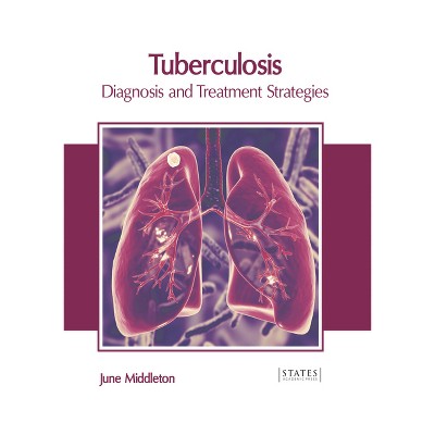 Tuberculosis: Diagnosis and Treatment Strategies - by  June Middleton (Hardcover)