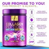 Collagen Peptides Powder Unflavored Grass Fed Collagen Powder Type I & III Collagen Supplements, Hyaluronic Acid, Biotin, 28 Servings By Hello Lovely! - 4 of 4