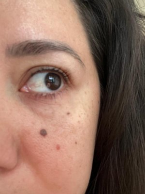 Guest review image 1 of 5, zoom in