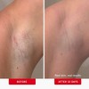 FIRST AID BEAUTY Ingrown Hair Pads, Pre-Shave Gentle Exfoliating Body Pads for Ingrown Hair Prevention - Ulta Beauty - 3 of 4
