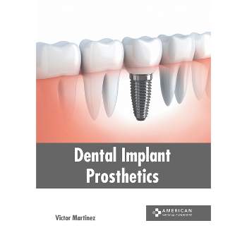Dental Implant Prosthetics - by  Victor Martinez (Hardcover)