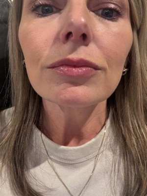 Guest review image 1 of 2, zoom in