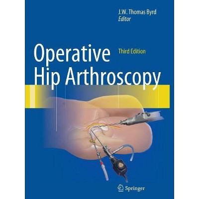 Operative Hip Arthroscopy - 3rd Edition by  J W Thomas Byrd (Paperback)