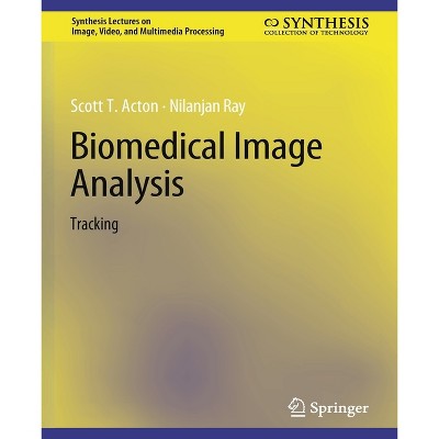 Biomedical Image Analysis - (Synthesis Lectures on Image, Video, and Multimedia Processin) by  Scott T Acton & Nilanjan Ray (Paperback)