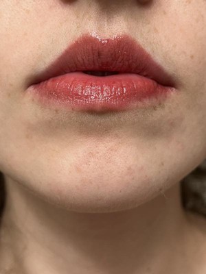 Guest review image 3 of 6, zoom in