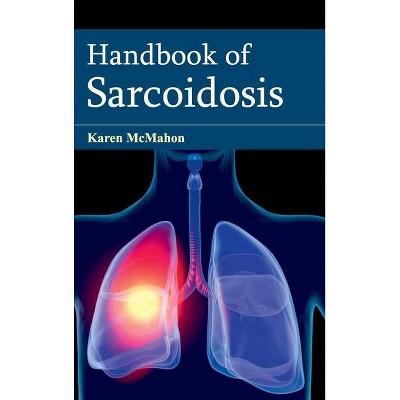 Handbook of Sarcoidosis - by  Karen McMahon (Hardcover)