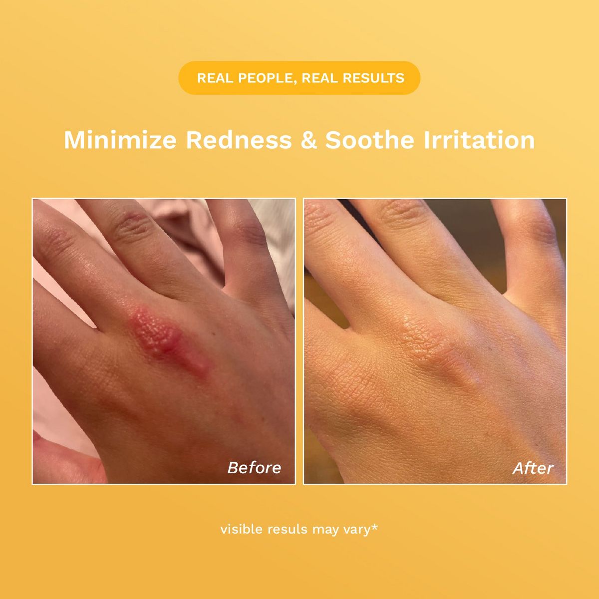 Rejuvaskin Skin Recovery Cream - thumbnail 7