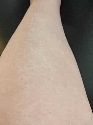 Guest review image 3 of 3, zoom in