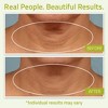 YEOUTH Neck Firming Cream with Vitamin C for Chin, Chest, and Décolletage - 4 of 4