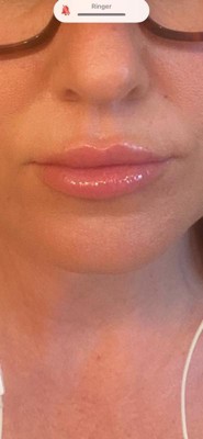 Guest review image 1 of 1, zoom in