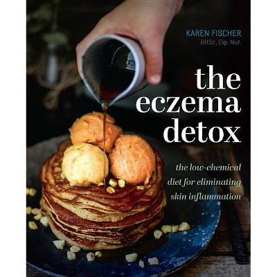 The Eczema Detox - by  Karen Fischer (Hardcover)