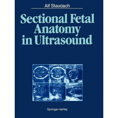 Sectional Fetal Anatomy in Ultrasound - by  Alf Staudach (Paperback)