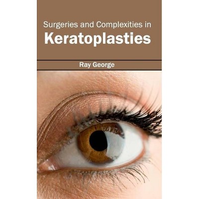 Surgeries and Complexities in Keratoplasties - by  Ray George (Hardcover)