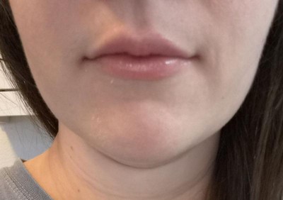 Guest review image 1 of 1, zoom in