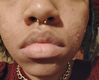 Guest review image 2 of 3, zoom in