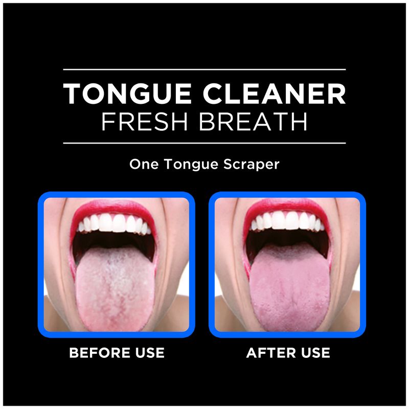 Orabrush Tongue Cleaner, 6 of 13