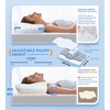 Itopfox Osteo Cervical Pillow for Neck Pain Relief, Hollow Design Odorless Memory Foam Pillows with Cooling Case, Orthopedic Bed Pillow for Sleeping - 4 of 4