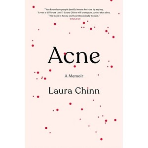 Acne - by  Laura Chinn (Hardcover) - 1 of 1