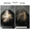 Phyto PHYTOCYANE (WOMEN) Densifying Treatment for Progressive Hair Thinning (12 Vials x 0.169 oz) Densify Serum for Thicker, Fuller Hair - 3 of 4
