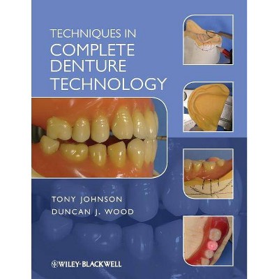 Techniques in Complete Denture - by  Duncan J Wood (Paperback)