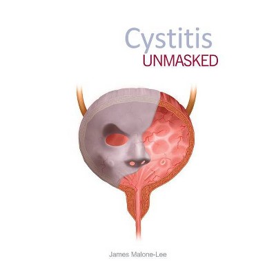 Cystitis Unmasked - by  James Malone-Lee (Paperback)