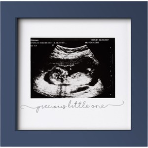KeaBabies Solo Baby Sonogram Picture Frame, Modern Ultrasound Picture Frames, Pregnancy Announcements Sonogram Frame - 1 of 4
