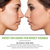 Grocerism 20% Glycolic Acid + 2% Salicylic Acid Pads - Exfoliating with Hyaluronic Acid & Aloe Vera - Facial Pads - 3 of 4