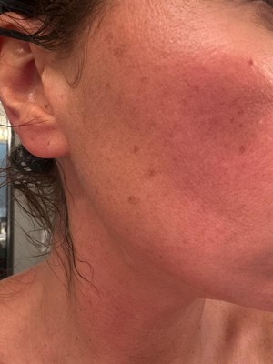 Guest review image 1 of 1, zoom in