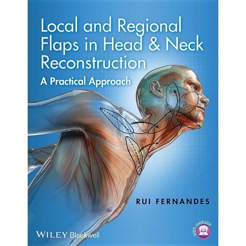 Local and Regional Flaps in Head and Neck Reconstruction - by Rui Fernandes  (Hardcover)