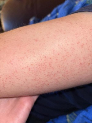 Guest review image 3 of 3, zoom in