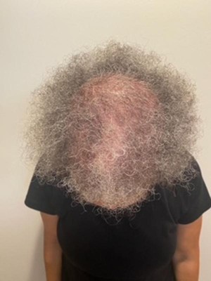 Guest review image 1 of 2, zoom in