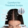 Tree To Tub Dry Scalp Spray - Intensive Scalp Moisturizer for Men & Women, Tea Tree Leave in Moisturizer for Dry Scalp, Flaky Buildup & Excess Oil - 4 of 4