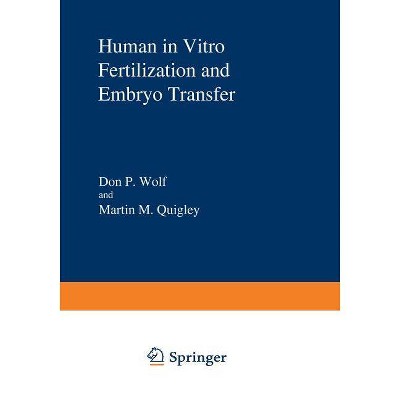 Human in Vitro Fertilization and Embryo Transfer - by  Don P Wolf & Martin M Quigley (Paperback)