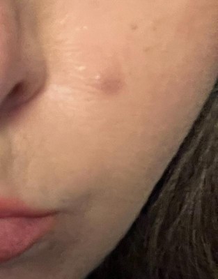 Guest review image 1 of 2, zoom in