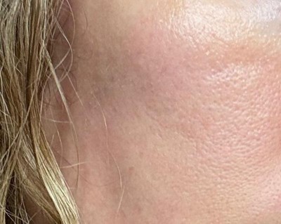 Guest review image 2 of 4, zoom in