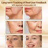 RF Facial Massager Device - EMS Face Lifting Tool, LED Red Blue Light Therapy, Ionic Skin Cleanser - Skincare for Women at Home or Travel - Silver - 3 of 4