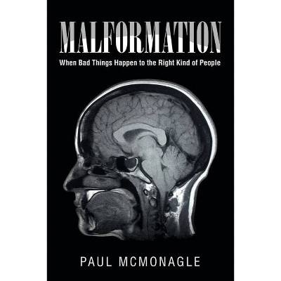 Malformation - by  Paul McMonagle (Paperback)