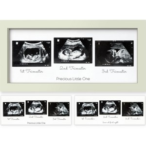 KeaBabies Trio Baby Sonogram Picture Frame, Baby Ultrasound Picture Frames for Baby Nursery, Mom to Be Gifts - 1 of 4
