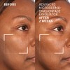 Advanced Face Exfoliator - 2 of 4