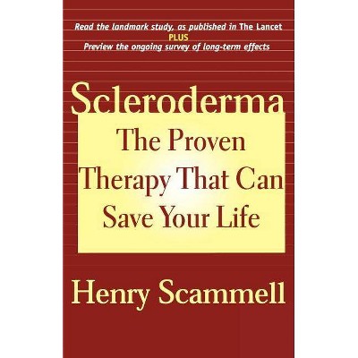 Scleroderma - by  Henry Scammell (Paperback)