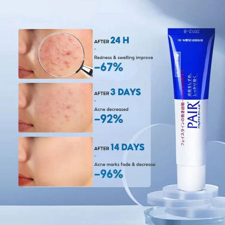 LION Japan Pair Acne Cream W (14 g) Calm the chaos and clear your skin with Japan’s favorite secret weapon.\, 3 of 6