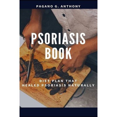 Psoriasis Book - by  Pagano G Pagano (Paperback)