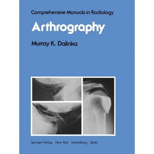 Arthrography - (Comprehensive Manuals in Radiology) by  M K Dalinka (Paperback) - 1 of 1