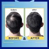 Mediceuticals Hydroclenz Dry Scalp Shampoo (33.8 oz) + Therapeutic Scalp & Hair Treatment Rinse (33.8 oz) - LITER DUO SET - 3 of 4