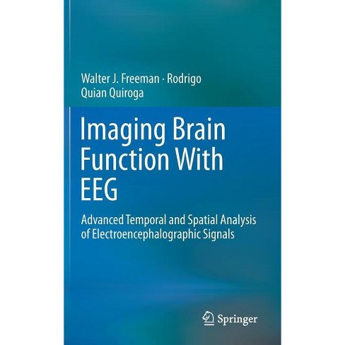 Imaging Brain Function With Eeg - By Walter Freeman & Rodrigo Quian ...